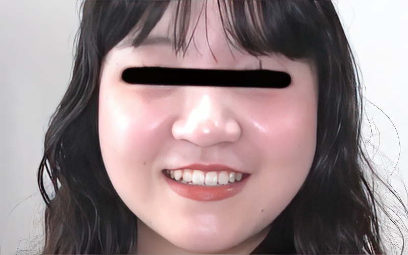 関口由衣
