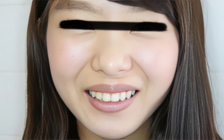 早坂佳純
